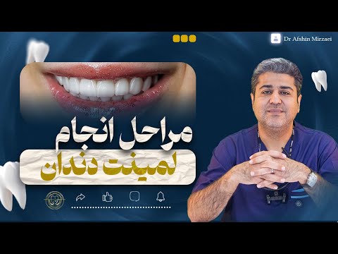 مراحل لمینت دندان از صفر تا لبخند نهایی توضیح کامل دکتر افشین میرزایی