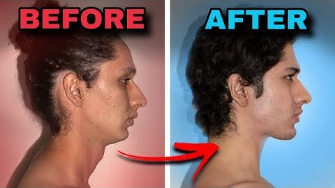 How To Mew Correctly (FULL GUIDE)