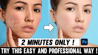 Skin Retouching In 2 Minutes | Photoshop Tutorial | Tamil | Pimple removing | Trending Photography screenshot 5