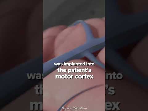 Brain-Computer Interface Startup