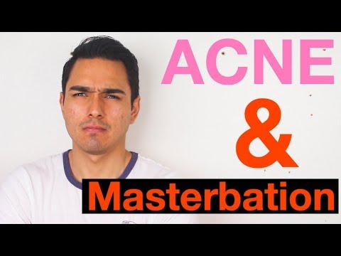 Does Masterbation Cause Acne??
