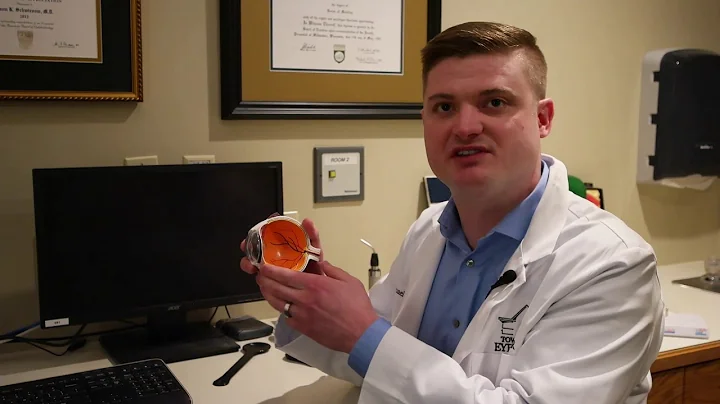 Dry eye causes and treatments with Dr. Michael Ser...