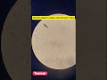 Human Sperm Under Microscope | மனித விந்தணுக்களின் நுண்ணக் காட்சி – Jayaram Tamil Embryologist