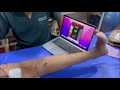 Mtrigger reload quadricep muscles and VMO.