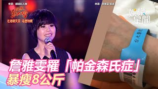 震撼彈!歌后詹雅雯曝左腦萎縮暴瘦8公斤 罹患帕金森氏症|娛樂星世界