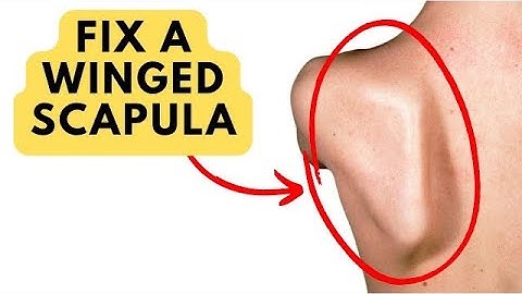 How To Fix A Winged Scapula & Shoulder Blade (the actual root cause)