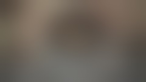 Combined XEN implant and intraoperative needling surgery