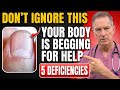 Doctor Warns: 5 DANGEROUS Deficiencies Your Body Could Be Warning You About After 60