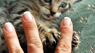 Поцарапала кошка ЧТО ДЕЛАТЬ и ЧЕМ ЛЕЧИТЬ, как восстановить кожу после царапины от кошки Поцарапала кошка ЧТО ДЕЛАТЬ и ЧЕМ ЛЕЧИТЬ, как восстановить кожу после царапины от кошки
