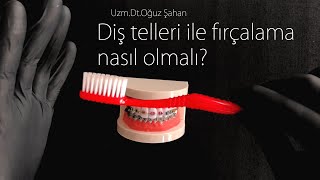 Uzm.dr.oğuz Şahan - Diş Telleri Ile Nasıl Diş Fırçalanır? Diş Telleri Nasıl Temizlenir?