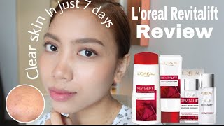 HOW TO GET CLEAR SKIN | PAANO KUMINIS | L’OREAL REVITALIFT PRODUCTS REVIEW | Belle Merto
