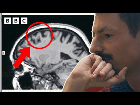 Son's Sees How Alzheimer's Affected His Mum's Brain Across The Years | The Jennings Vs Alzheimer's