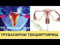 БАЧАДОН НАЙИНИ ТЕКШИРТИРИШ ШАРТЛАРИ