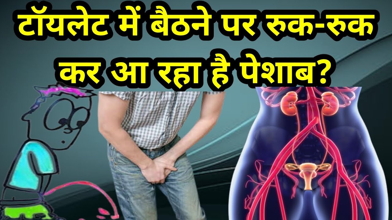 पेशाब रुक-रुक कर आने लक्षण और इलाज|peshab ruk ruk kar ana ka ilaj|urine ruk ruk kar aana ...