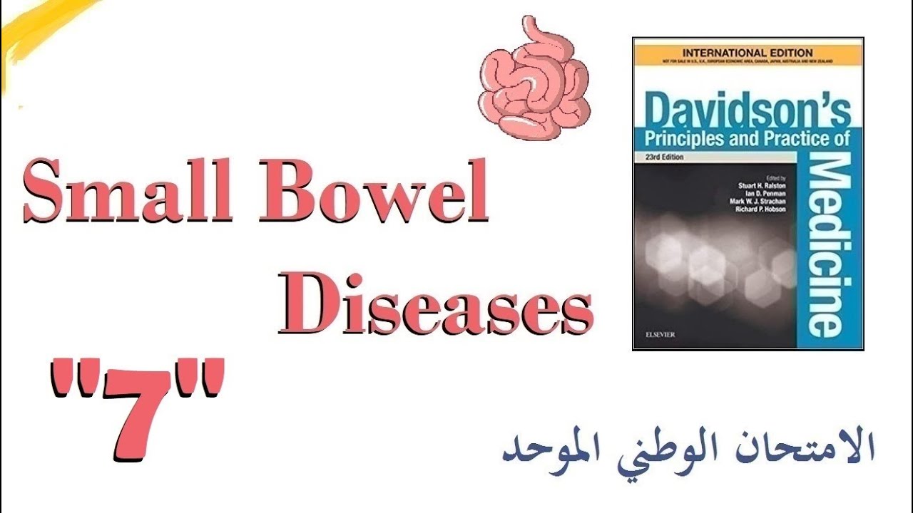Meckel's Diverticulum |  الامتحان الوطني الموحد | رتج ميكل