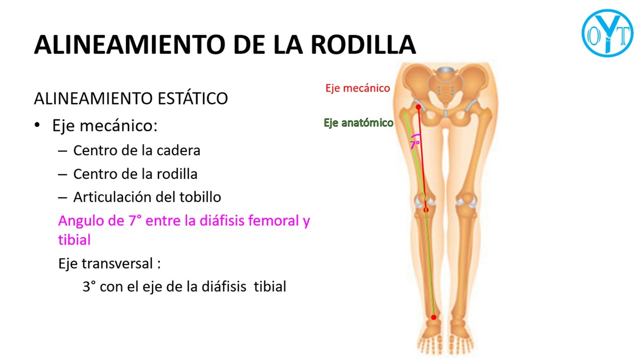 técnica de artroplastía de rodilla, alineamiento de la rodilla YouTube
