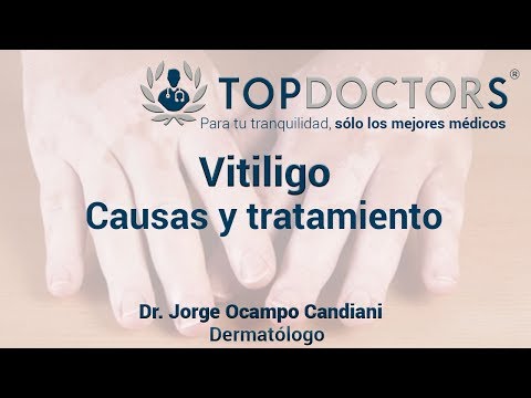 Vídeo: Vitiligo: Causas, Métodos De Tratamiento