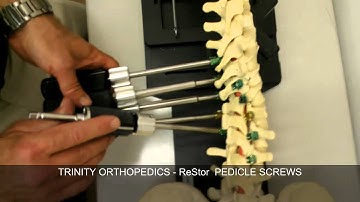 S2 SCREW and ROTATION CORRECTION