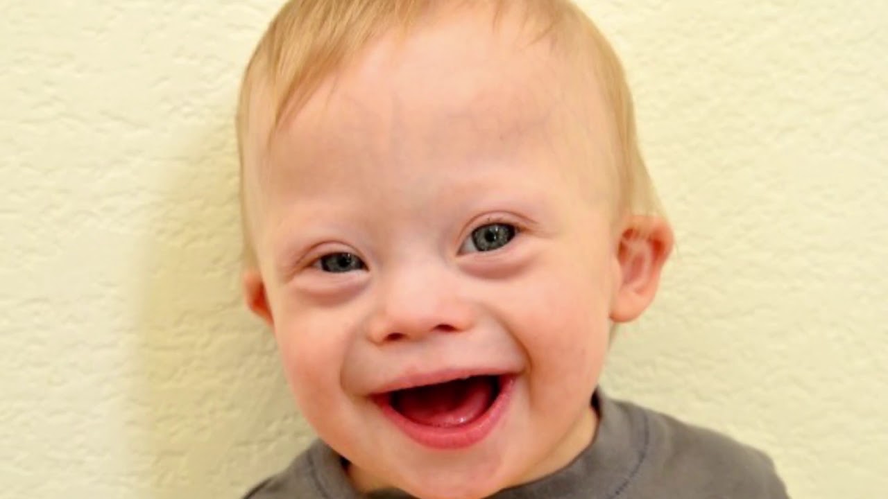 Tv Tera Bitola Sareni corapi na denot na licata so Daunov sindrom 21 03 - YouTube