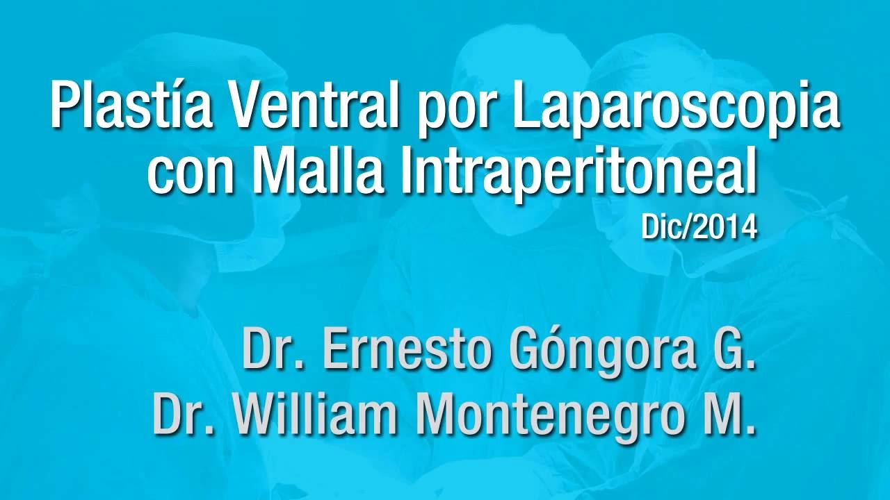 abdominales en 8 minutos HERNIA ABDOMINAL Plastía Ventral por Por Laparoscopía con Malla Intraperitoneal