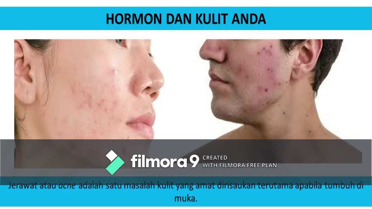 Kulit & Jerawat 