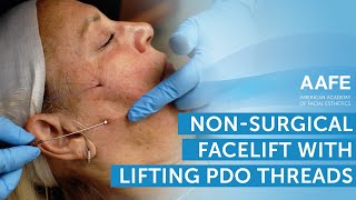 Non-Surgical Facelift with Lifting PDO Threads! | AAFE screenshot 4