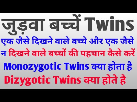 Twins Pregnancy in Hindi जुड़वा बच्चों के प्रकार   By- Deepak Dewangan