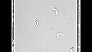 Microfluidics-based single cell analysis reveals drug-dependent motility changes in trypanosomes