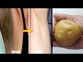 Underarms Whitening Home Remedy Fast | Lighten up your armpits 100% at home