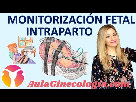 Video: ¿Qué es la monitorización fetal durante el trabajo de parto?