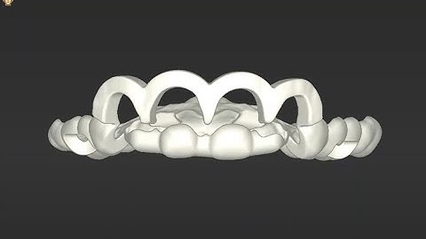 gingivectomy guide EN