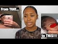 MY EDGES WERE COMPLETELY GONE!?!| Secrets on how I regrew my edges