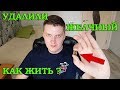 Мне УДАЛИЛИ ЖЕЛЧНЫЙ ПУЗЫРЬ! КАК дальше ЖИТЬ? Желчекаменная болезнь (ЖКБ) холелитиаз #3