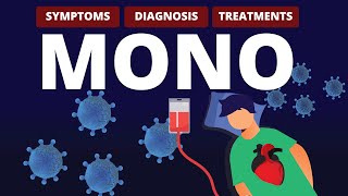 What is MONO? Symptoms, Diagnosis & Treatments