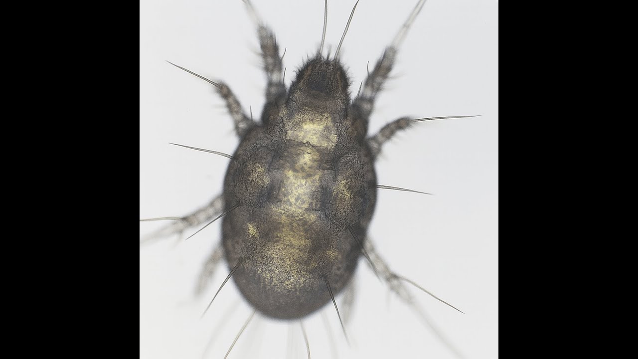 Flour mite (Acarus siro) 10X-40X  Bresser Biolux Touch 5MP Part 2