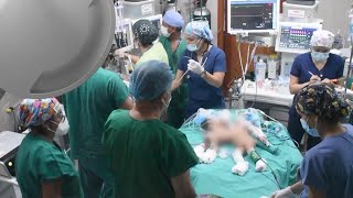 Babies Born Conjoined at the Abdomen Separated in Surgery