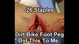 How Not To Load A Dirt Bike -- 26 Staples