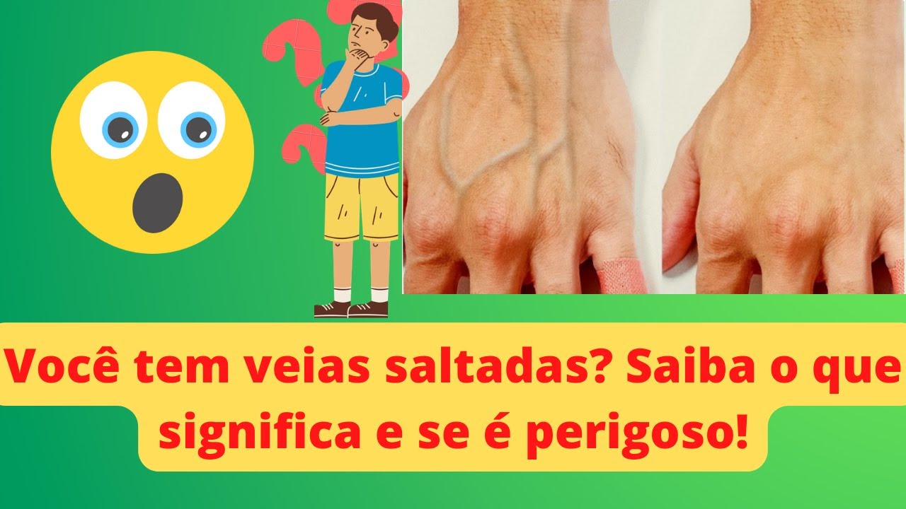 Quando As Veias Ficam Saltadas O Que Pode Ser?