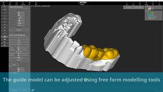 AIS 3D APP Surgical Guide Design screenshot 3
