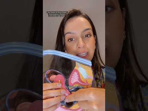 Vídeo: Devo sentir as cordas do meu iud?