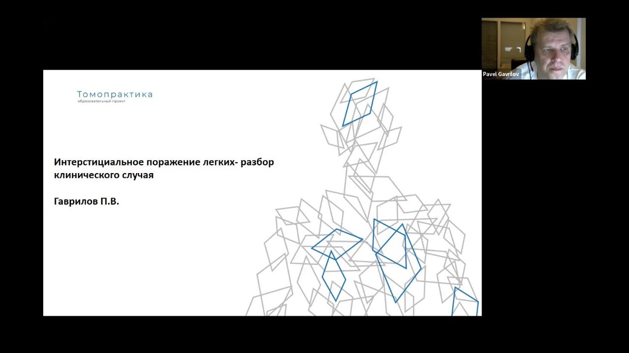 Интерстициальное поражение легких разбор клинического случая