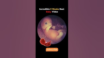 9 Weeks Baby Real Video From Womb 😍Incredible #pregnancy #fetus