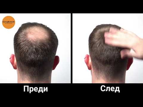 Видео: Разлика между вътрешните и външните клетки на косата