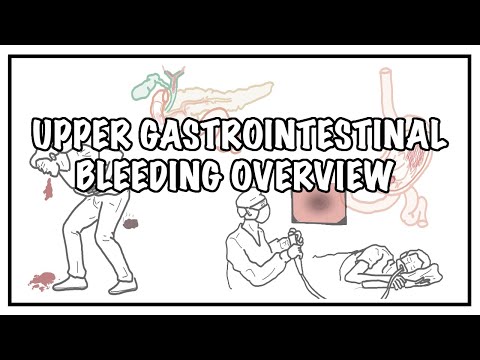 Wideo: Jak leczyć krwawienie z górnego odcinka przewodu pokarmowego: 11 kroków
