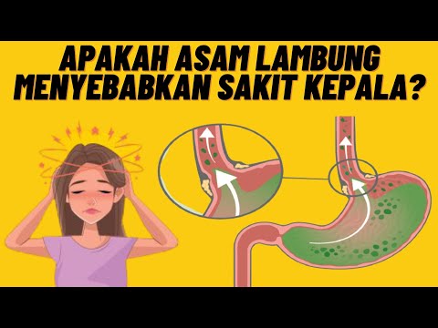 Video: Apakah lambung menyebabkan sakit kepala?