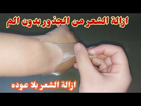 ازاله شعر الوجه وفوق الشفايف ومنع نموه بمكون فى مطبخك,بشره بيضاء وصافيه ولو شعرك كتير 100 % ناجحة