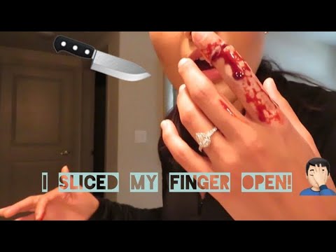 best-prank-on-fiancÉ!!-(sliced-off-finger-prank)