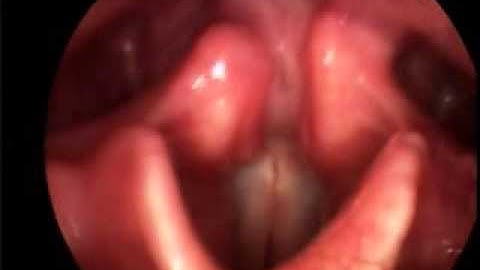 Singing Vocal Folds