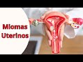 Cómo tratar los MIOMAS UTERINOS con DIGITOPRESIÓN