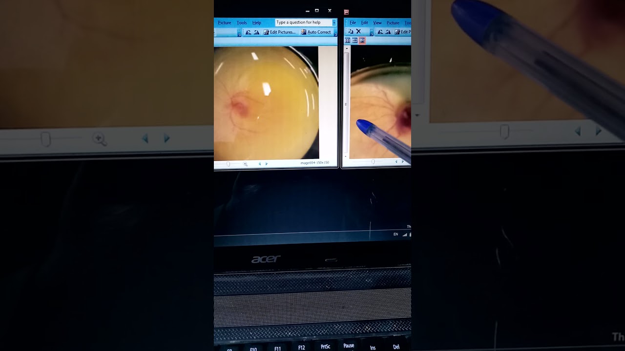 تعرف على سبب هلاك اجنة البيض ان كان من المفقسه ام من البيض